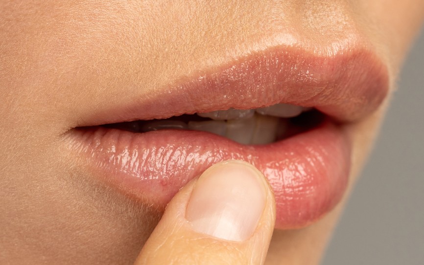 A partir de quel âge avoir recours à la médecine esthétique pour les lèvres ? | Le Cannet-des-Maures | Dr Paitel