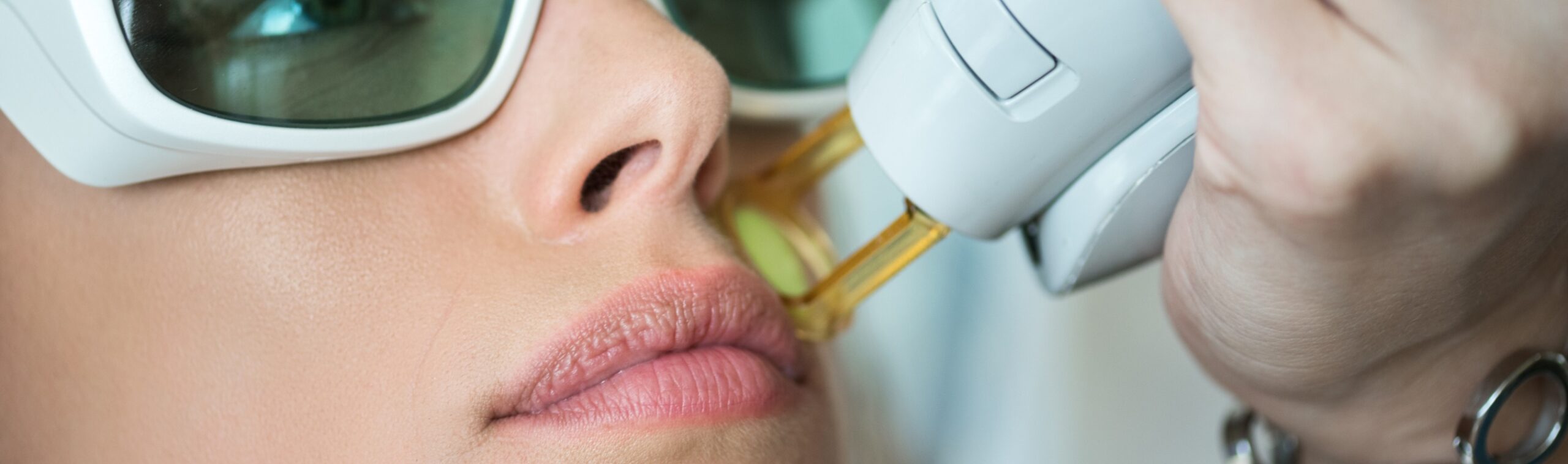 Epilation laser remboursée | Le Cannet-des-Maures | Dr Paitel